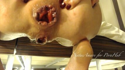 Геморройная любовь анального секса