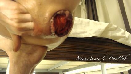 Геморройная любовь анального секса